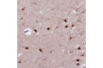 Immunohistochemical staining of human hippocampus shows strong nuclear positivity in neuronal cells.