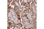 Immunohistochemical staining of human placenta shows moderate to strong granular cytoplasmic positivity in trophoblastic cells.