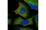 Immunofluorescent staining of human cell line U-2 OS shows localization to cytosol.
