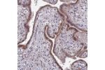 Immunohistochemical staining of human placenta shows cytoplasmic positivity in trophoblasts.