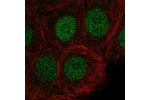 Immunofluorescent staining of human cell line MCF7 shows localization to nucleoplasm.