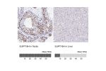 Immunohistochemistry analysis in human testis and liver tissues using HPA049787 antibody. Corresponding SUPT16H RNA-seq data are presented for the same tissues.