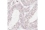 Immunohistochemical staining of human testis shows weak nuclear positivity in cells in seminiferous ducts and Leydig cells.