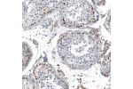 Immunohistochemical staining of human testis shows moderate to strong nuclear positivity in cells in seminiferous ducts.