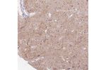 Immunohistochemical staining of human cerebral cortex shows moderate cytoplasmic positivity in neurons and neuropil.