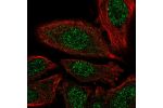 Immunofluorescent staining of human cell line PC-3 shows localization to nucleoplasm.