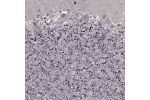 Immunohistochemical staining of human cerebellum shows strong nuclear positivity in cells in granular layer.