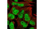 Immunofluorescent staining of human cell line HEK 293 shows localization to nucleoplasm.