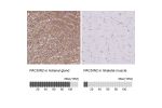 Immunohistochemistry analysis in human adrenal gland and skeletal muscle tissues using HPA049854 antibody. Corresponding PACSIN2 RNA-seq data are presented for the same tissues.