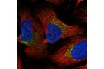 Immunofluorescent staining of human cell line U-2 OS shows localization to vesicles.