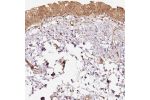 Immunohistochemical staining of human urinary bladder shows strong cytoplasmic positivity in urothelial cells.