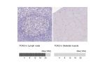 Immunohistochemistry analysis in human lymph node and skeletal muscle tissues using HPA049900 antibody. Corresponding TOX2 RNA-seq data are presented for the same tissues.