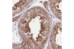 Immunohistochemical staining of human testis shows moderate to strong cytoplasmic positivity in cells in seminiferous ducts.