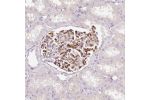 Immunohistochemical staining of human kidney shows strong membranous positivity in cells in glomeruli.