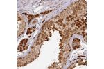 Immunohistochemical staining of human testis shows strong cytoplasmic and nuclear positivity in cells in seminiferus ducts, Leydig cells exhibited strong cytoplasmic staining.