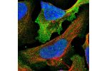 Immunofluorescent staining of human cell line U-2 OS shows localization to nucleus & plasma membrane.