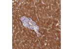 Immunohistochemical staining of human liver shows strong cytoplasmic positivity in hepatocytes.