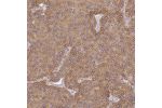 Immunohistochemical staining of human parathyroid gland shows moderate positivity in glandular cells.