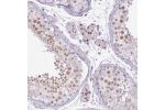Immunohistochemical staining of human testis shows moderate nucleolar positivity in cells in seminiferus ducts and Leydig cells.