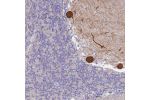 Immunohistochemical staining of human cerebellum shows strong cytoplasmic positivity in Purkinje cells.