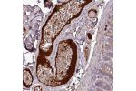 Immunohistochemical staining of human duodenum shows positivity in plasma.