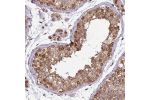 Immunohistochemical staining of human testis shows strong nuclear membranous positivity in cells in seminiferous ducts.