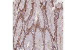Immunohistochemical staining of human stomach, upper shows moderate cytoplasmic and nuclear positivity in glandular cells.