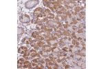Immunohistochemical staining of human stomach, lower shows strong cytoplasmic positivity in parietal cells.