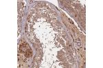 Immunohistochemical staining of human testis shows moderate cytoplasmic positivity in cells in seminiferous ducts.