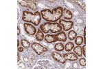 Immunohistochemical staining of human kidney shows strong nuclear positivity in cells in tubules.