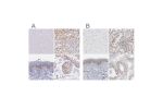 Immunohistochemical staining of human cerebral cortex, kidney, skin and testis using Anti-SYNE2 antibody HPA050204 (A) shows similar protein distribution across tissues to independent antibody HPA003435 (B).