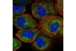 Immunofluorescent staining of human cell line A-431 shows localization to cytosol.