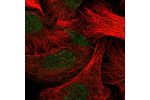 Immunofluorescent staining of human cell line U-2 OS shows localization to nucleoplasm & vesicles.