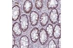 Immunohistochemical staining of human rectum shows strong nuclear positivity in glandular cells.