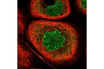 Immunofluorescent staining of human cell line A-431 shows localization to nucleoplasm, nuclear membrane & cytosol.