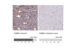 Immunohistochemistry analysis in human lymph node and pancreas tissues using Anti-PSMB8 antibody. Corresponding PSMB8 RNA-seq data are presented for the same tissues.