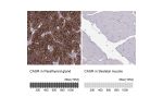 Immunohistochemistry analysis in human parathyroid gland and skeletal muscle tissues using HPA050335 antibody. Corresponding CASR RNA-seq data are presented for the same tissues.