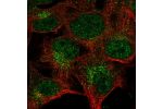 Immunofluorescent staining of human cell line SK-MEL-30 shows localization to nucleoplasm & vesicles.
