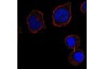 Immunofluorescent staining of human cell line HEL shows localization to midbody.