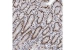 Immunohistochemical staining of human stomach, upper shows strong nuclear positivity in glandular cells.