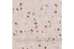 Immunohistochemical staining of human cerebral cortex shows moderate cytoplasmic positivity in neurons.
