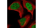 Immunofluorescent staining of human cell line U-2 OS shows localization to nucleoplasm.