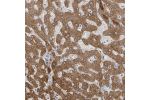 Immunohistochemical staining of human liver shows strong cytoplasmic positivity in hepatocytes.