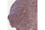 Immunohistochemical staining of human tonsil shows strong nuclear positivity in non-germinal center cells.
