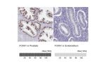 Immunohistochemical staining of human urinary bladder shows strong nuclear positivity in urothelial cells.
