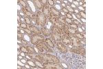 Immunohistochemical staining of human kidney shows moderate cytoplasmic positivity in cells in tubules.
