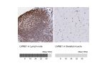 Immunohistochemistry analysis in human lymph node and skeletal muscle tissues using HPA050524 antibody. Corresponding LMNB1 RNA-seq data are presented for the same tissues.