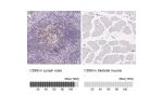 Immunohistochemistry analysis in human lymph node and skeletal muscle tissues using HPA050525 antibody. Corresponding CD69 RNA-seq data are presented for the same tissues.