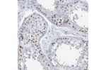 Immunohistochemical staining of human esophagus shows moderate nuclear positivity in squamous epithelial cells.