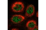 Immunofluorescent staining of human cell line A-431 shows localization to nucleoplasm.
